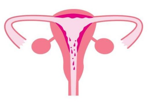 一直生女孩可以做试管男孩吗？剖腹产后多久才能做试管