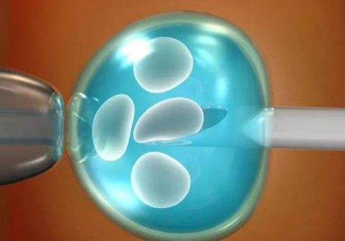 更年期月经提前半个月的原因分析，教你这三个调理措施